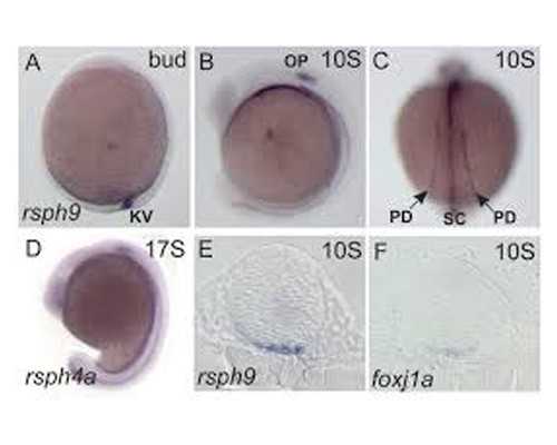 这5点是导致鲜胚移植后容易双胎的原因，怎样能更省钱！-生子借卵试管