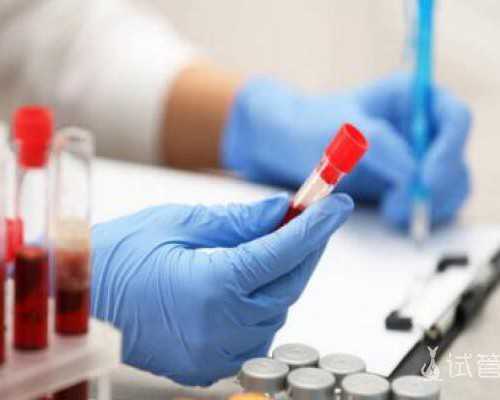 美国试管婴儿哪家价格底