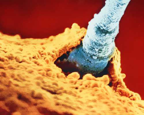 香港验血隔多久可以再验_香港验血验男女会故意吗_验血查男女几周是最准呢