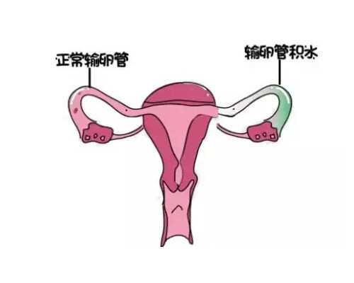 香港验血联系方式妈妈网_怀孕两个月香港查男女准吗_验血查性别需要多少钱