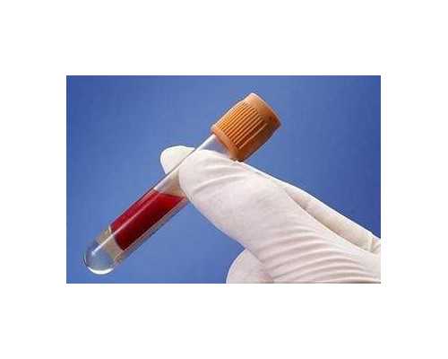 香港验血9周加4天 结果准确吗_香港验血mk_抽血验男女有多少翻盘!