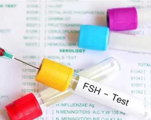 香港验血几周可以查_香港验血测胎儿性别费用_性别鉴定哪个验血机构最权威