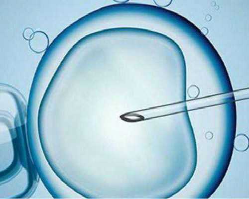 广州试管公司招聘,保安公司招聘-代孕成功率如何