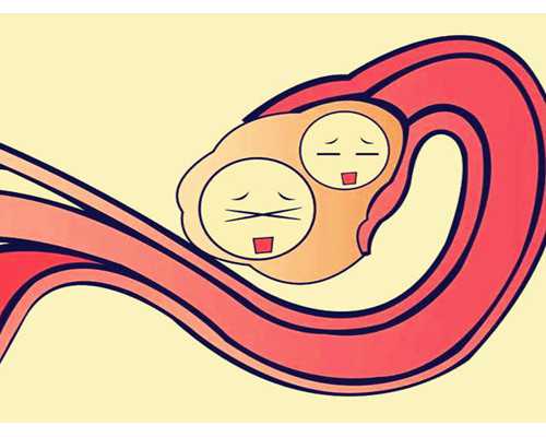 泰国做试管婴儿多钱