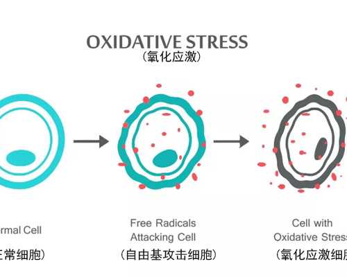 盆腔炎会导致不孕吗？做好这3点让你远离盆腔炎！-助孕代怀生子