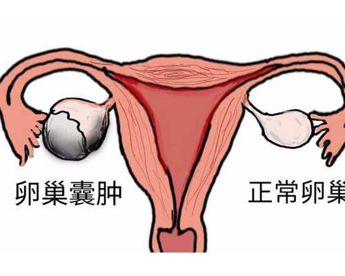 香港验血正规几天出结果_香港验血是男的准不准,有没有验血最后翻盘的?