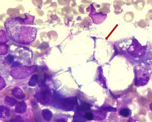 卵巢萎缩可做试管吗 卵巢萎缩能做试管吗