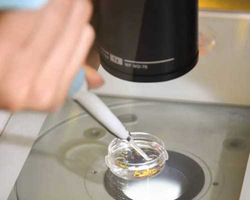 邮寄香港验血宝妈都是怎么抽血的啊_如果想验血看男女一定要去香港查吗_查男