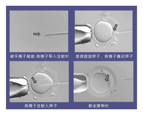 香港验血查性别有没有出错概率_香港验血15个全是+ve准不准_过来人来告诉你真