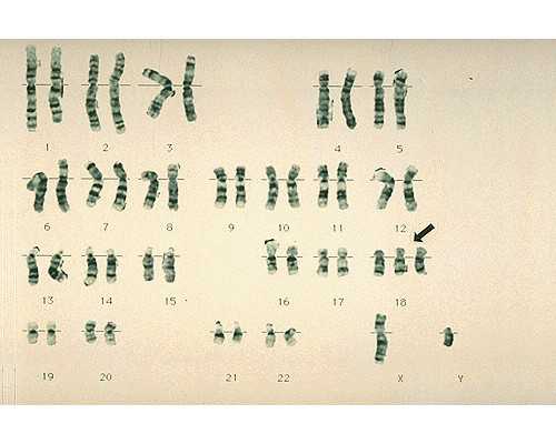 网上古玩交易平台哪个好_艺术品投资应避开泡沫品种