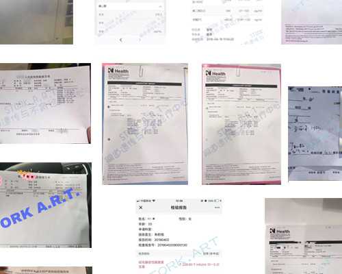 美国试管婴儿的优点和缺点