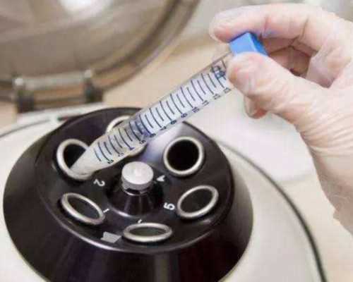 香港验血咨询电话_香港+验血+生男女准吗_验血攻略及流程说明