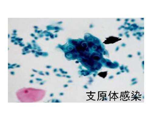 便秘的原因是什么呢？产后便秘会子宫下垂吗？