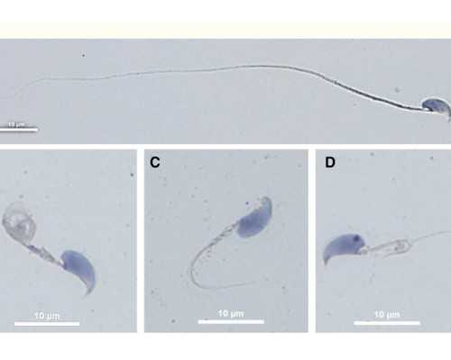 怀孕35天香港能验血吗_内地验血查男女寄到香港_早期验血测男女可不可靠