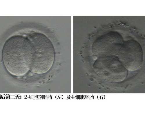 甲亢做试管婴儿怀孕后要注意什么事项？甲亢试管移植影响大不大？