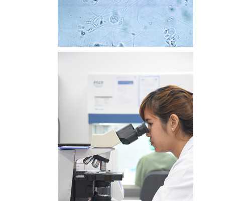 诱导排卵周期移植方案是什么意思？-代怀孕价格