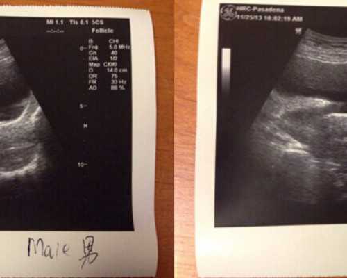 我的泰国NIC医院试管婴儿攻略