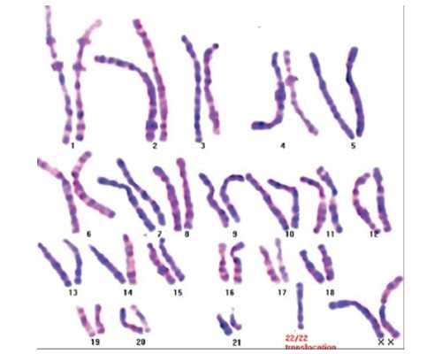 艾灸对孕妇有影响吗