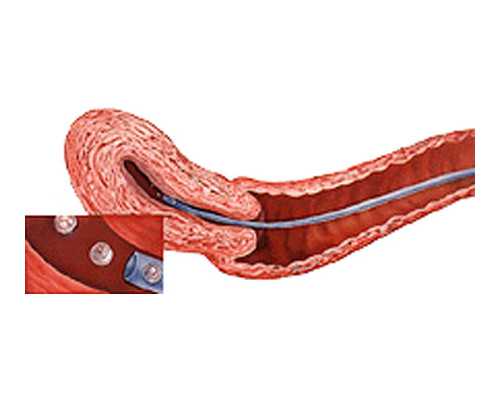 深圳古玩收藏品店_文化修养是当代画家的短板