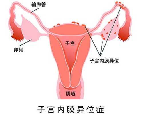 2023日照不孕不育医院排名，本市暂无一家试管婴儿助孕机构-代生包男宝