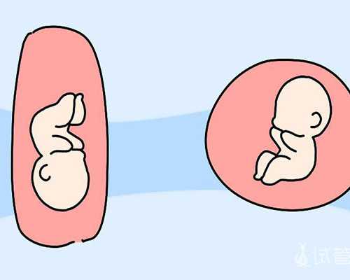 子宫内膜息肉摘除手术