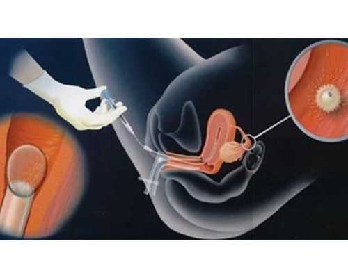 怀孕一个月验血搜香港卓信_香港验血鉴定男女当天可以出结果吗_性别鉴定哪个