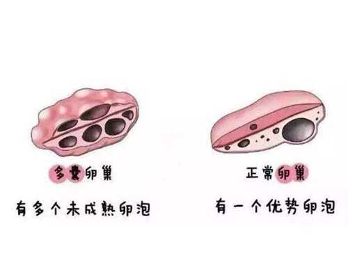 怀孕香港验血查的有y染色体_香港验血团队太大_测性别到底哪家是真的!