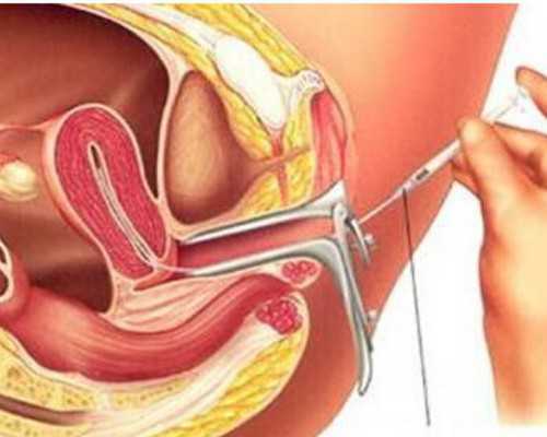 十八周香港时代验血_能亲自去香港诊所预约验男女吗_DNA鉴定需要哪些条件!