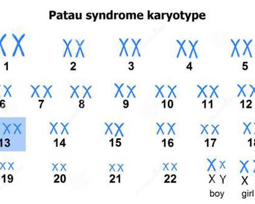 在日本做第三代试管婴儿手术费用大概是多少