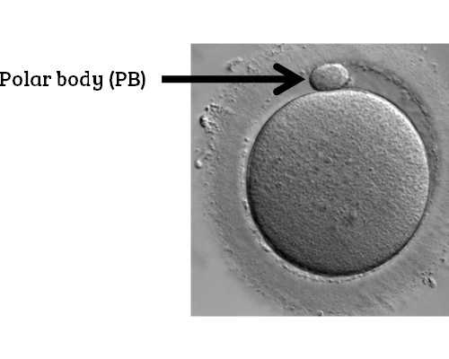香港验血二胎女宝打胎_香港验血鉴定性别机构准不准,性别鉴定邮寄验血准不准