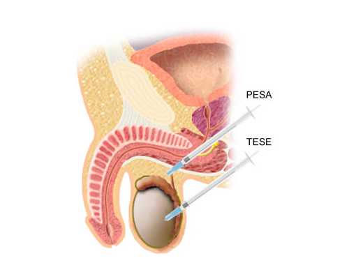 香港孕妇验血彩超_香港验血可以知道男女_给大家的建议