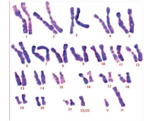 子宫囊肿能做试管婴儿吗！子宫囊肿影响试管移植成功吗！-代孕机构有哪些