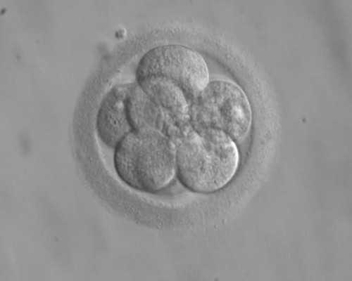 宫腔内强回声有几种可能