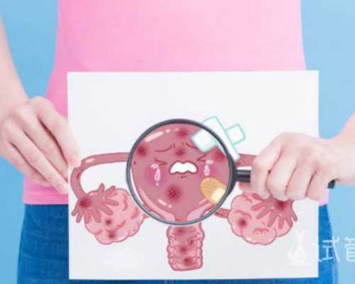 闭经会导致卵巢囊肿么闭经和卵巢囊肿之间有什么影响-助孕生子机构
