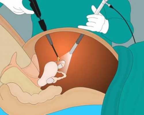 俄罗斯试管婴儿供卵（俄罗斯试管供卵是不是混血）