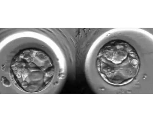 内膜7mm能不能做试管移植？内膜7mm移植成功率高吗-去农村找女孩代孕