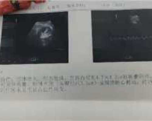 私人古玩交易_陆放与西湖