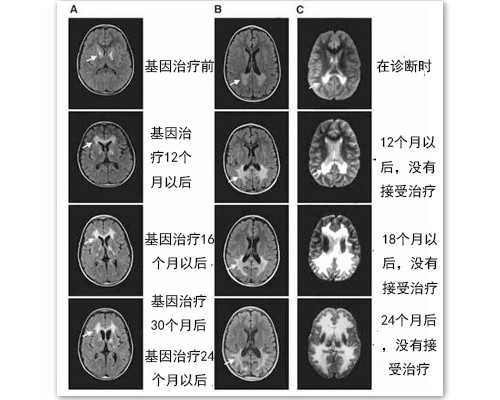美国试管婴儿攻略，去美国做试管成功率和费用-代孕中心包生女孩