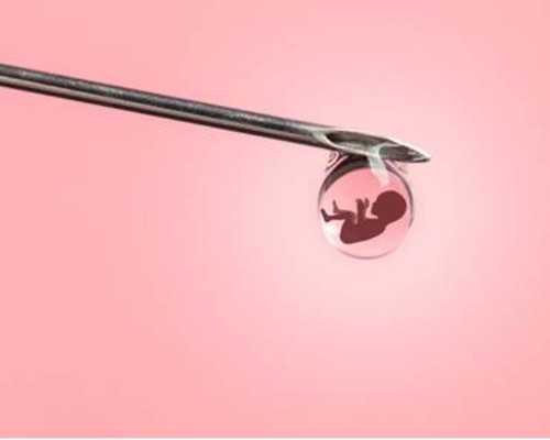 香港验血7周怎么算的_香港验血测男女后可进行无痛人流么_性别鉴定真的有那么