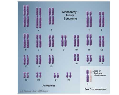 卵巢囊肿闭经治疗方法有哪些闭经后卵巢囊肿怎么治疗