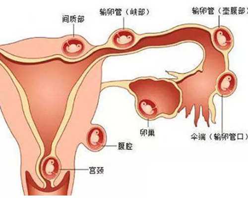 香港验血孕妇要注意什么_你是我的一本书作文600字，要自己写的《你是我的一