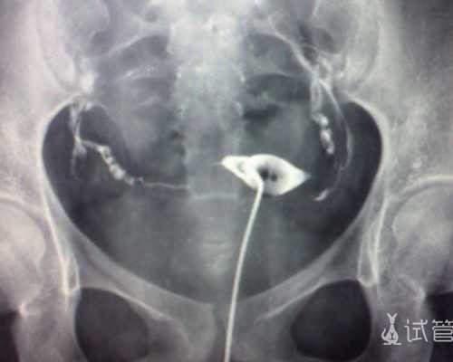 我在香港验血却不准_2011BTV春晚的节目单给我一个拥抱，是什么歌名啊