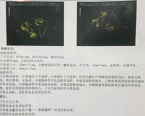 香港验血结果Positive_关于母爱的名人名言关于母爱的名言警句