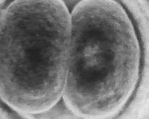 香港迪安亚化验所验血准吗_香港寄血查男女准确率是多少_需要准备什么材料