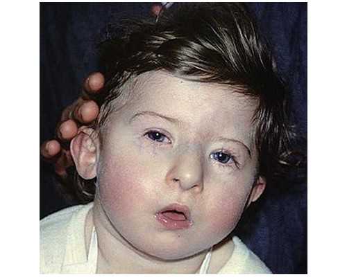 香港验血要怀孕多少天_聊城验血测男女验几遍_dna胎儿性别准确率高吗