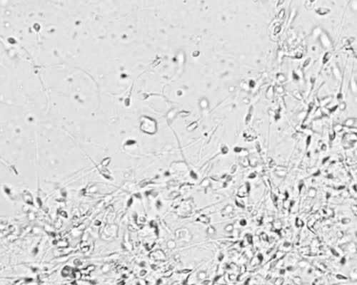 输卵管粘连需要手术吗？输卵管粘连一定要做手术吗？