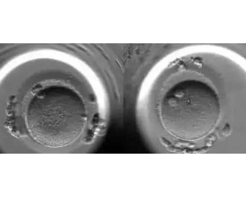 2020张兰古玩城交流会时间_利于春季养生的食物