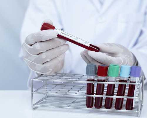 有没有妈妈寄过血液到香港验血_一部红色电影观后感（300-----400字即可）《黄河