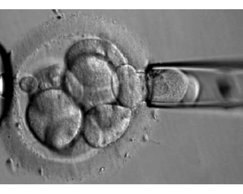 香港验血678周都一样吗_香港验血查性别mk中心_哪个验血机构最准!