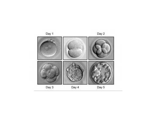 香港验血孕妇要注意什么_香港验血宝宝性别多久可以去？分享一下本人亲身经